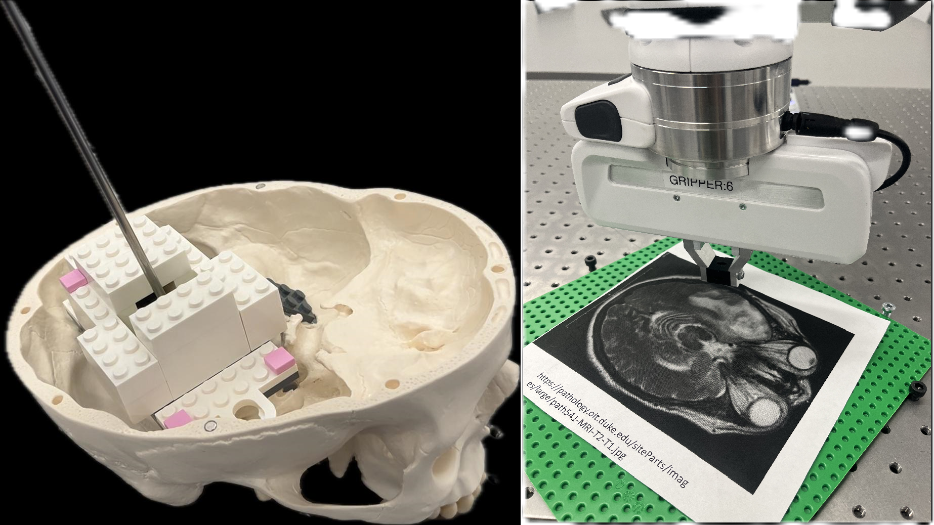 Autonomous Medical Robot